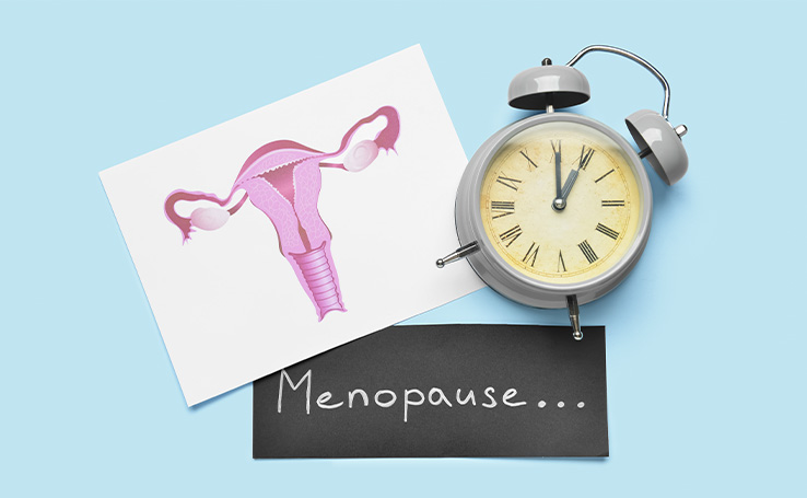 desenho de um sistema reprodutor feminino ao lado de um relógio e uma placa escrita menopausa